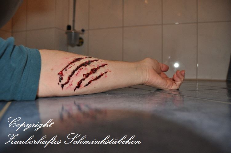 arm_wunde.jpg